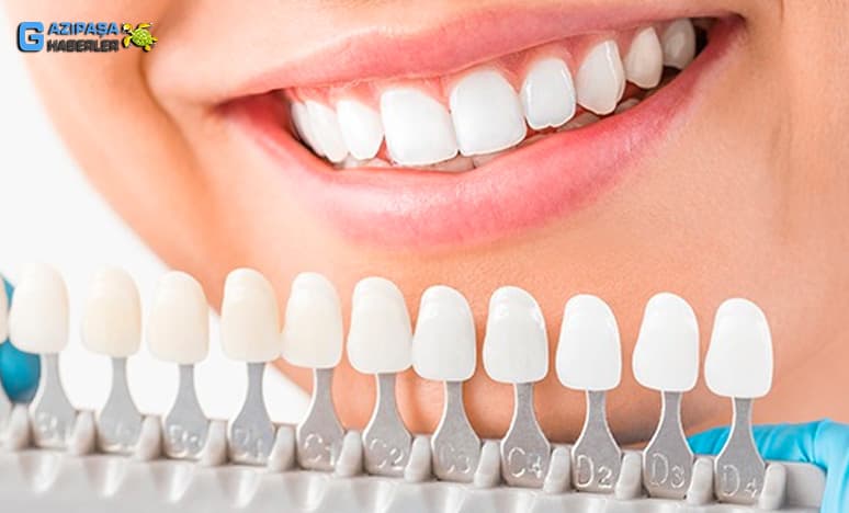 Estetik Diş Hekimliği Nedir? Estetik Dişlerin Önemi...