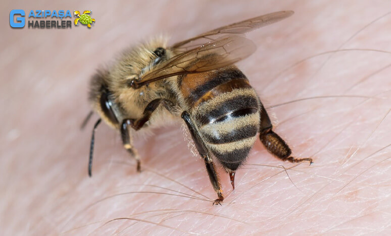 Arı İğnesi Nedir? Arı İğnesinin Faydaları Nelerdir?